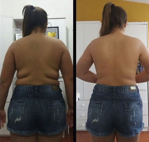 Before after back view